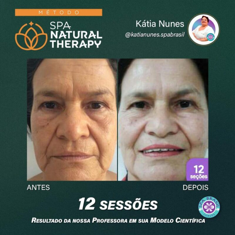 Método SPA NATURAL THERAPY depoimento e resultados prints de alunos