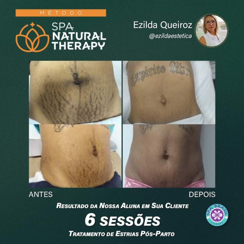 Método SPA NATURAL THERAPY depoimento e resultados prints de alunos