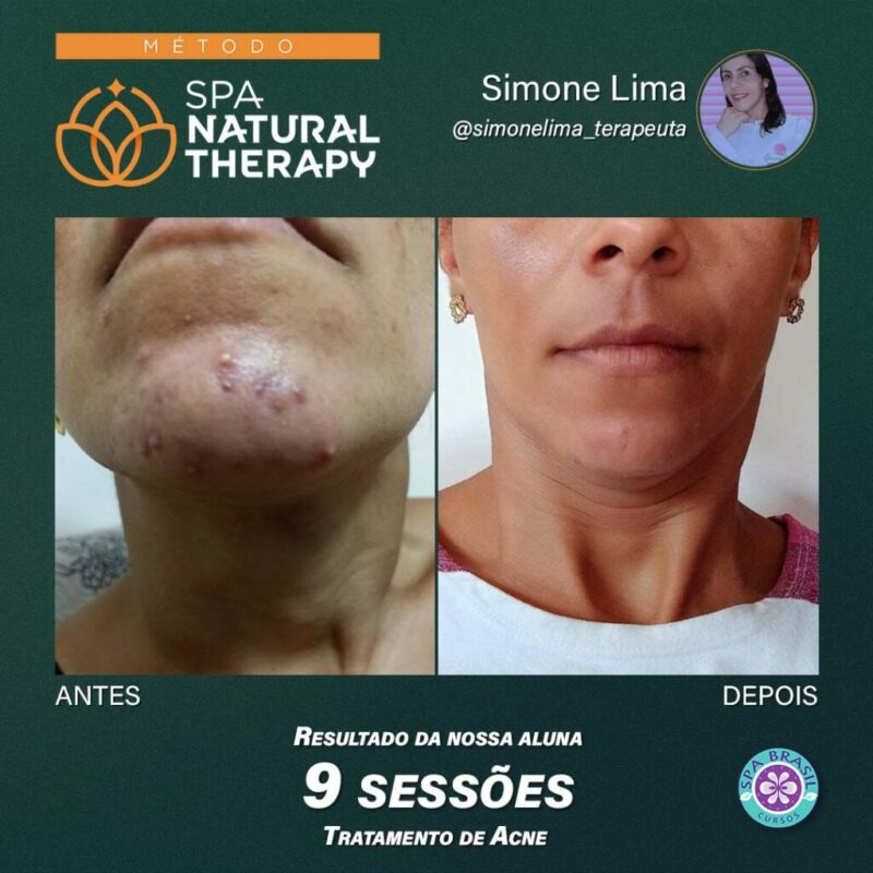 Método SPA NATURAL THERAPY depoimento e resultados prints de alunos