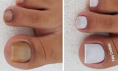 Curso de Pedicure Com Certificado é Bom