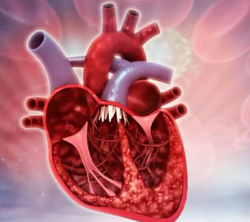 Mentoria Domine as Emergências Cardiológicas é Bom