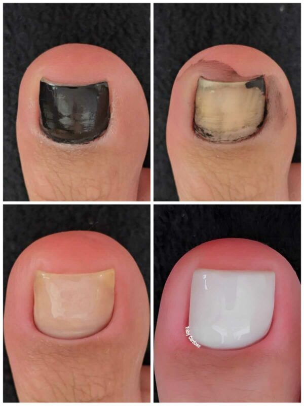Curso Pedicure Sem Segredos promocao com cupom de desconto